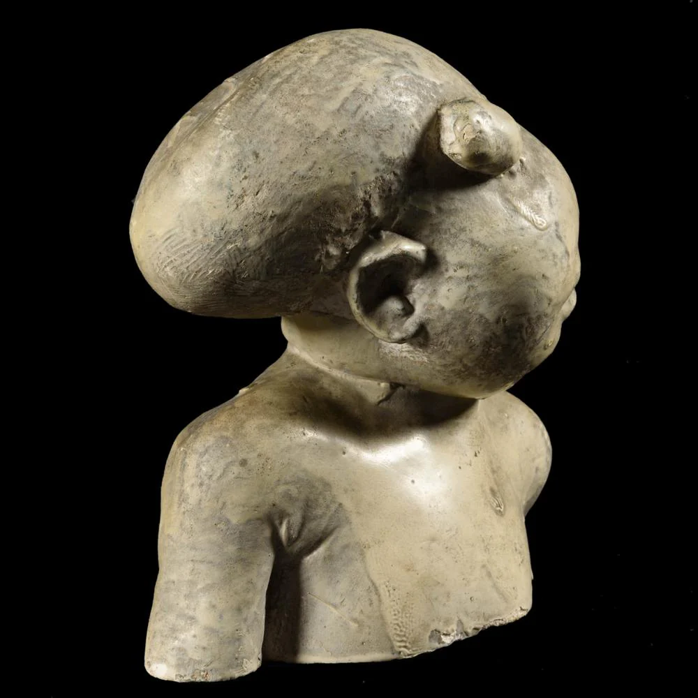 RARE MOULAGE ANATOMIQUE : FŒTUS CYCLOPE XIXᵉ - Image 3