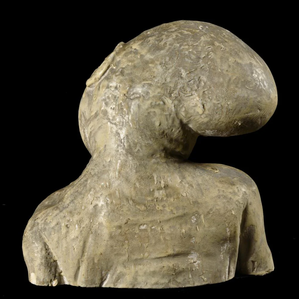 RARE MOULAGE ANATOMIQUE : FŒTUS CYCLOPE XIXᵉ - Image 4