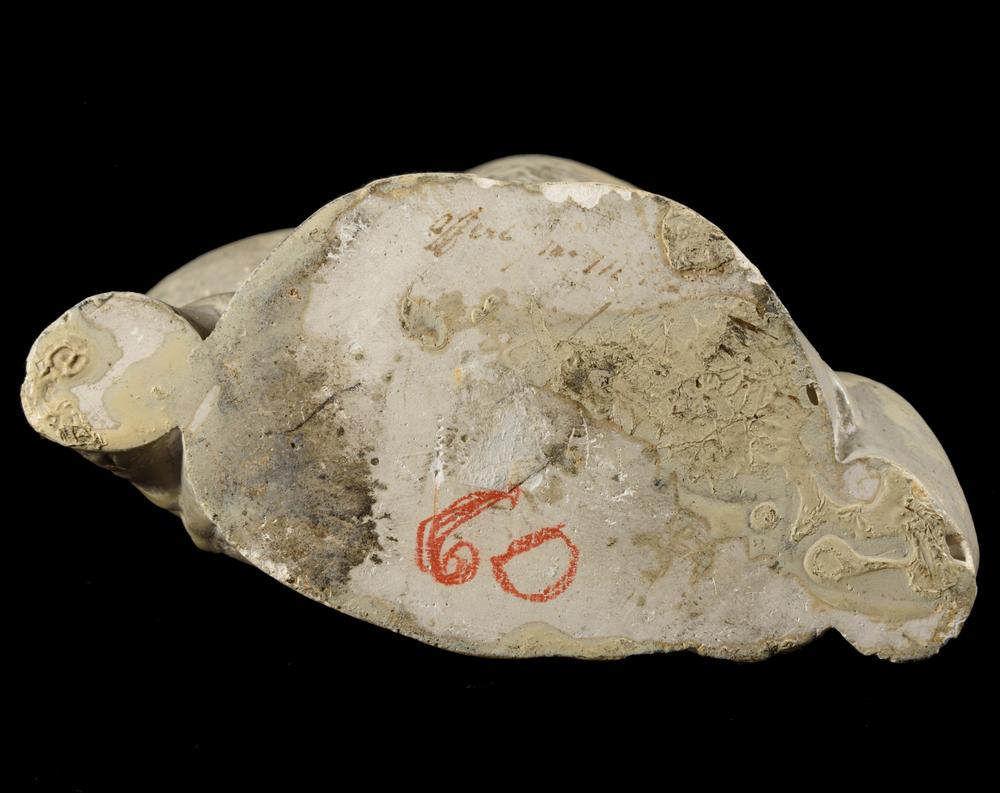 RARE MOULAGE ANATOMIQUE : FŒTUS CYCLOPE XIXᵉ - Image 5
